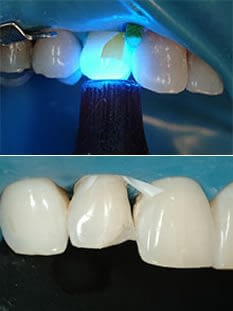 Albía Clínica Dental - Odontología conservadora